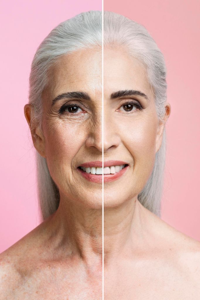 Anti-Aging Treatment in Kondhwa & NIBM | Dr. Seema Hashmi