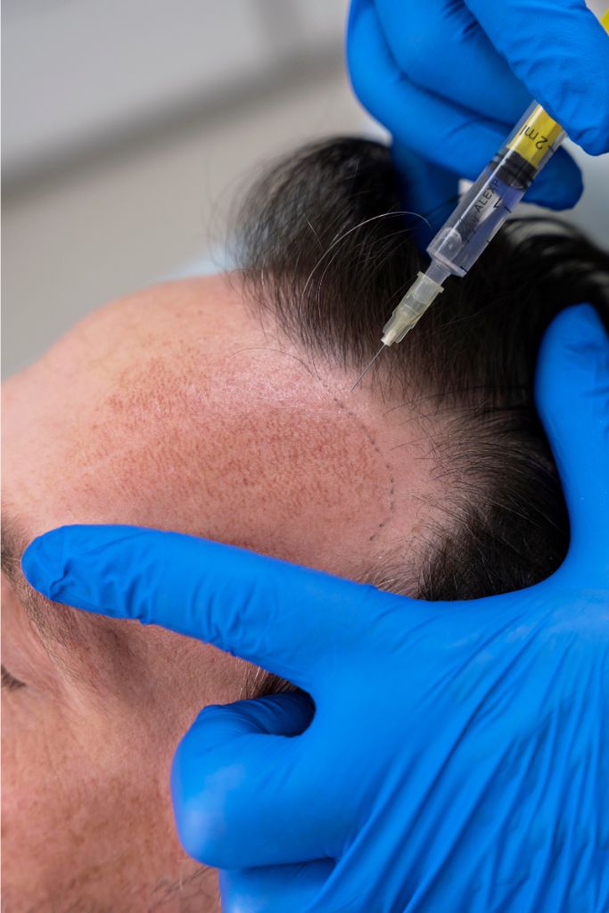 Hair Transplant Clinic in Kondhwa & NIBM, Pune