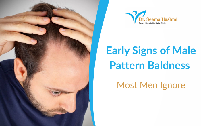 Early Signs of Male Pattern Baldness & When to See a Dermatologist