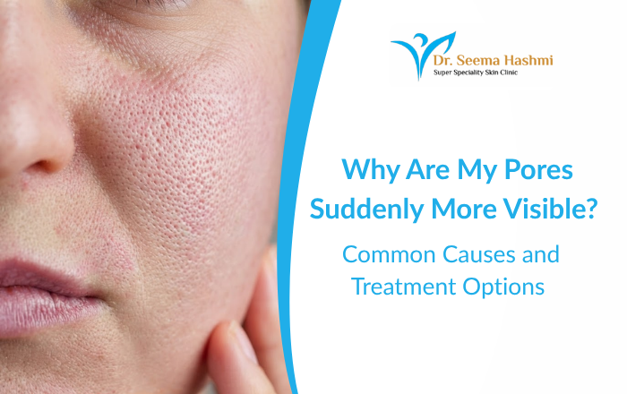 Why Are My Pores Suddenly More Visible Common Causes and Treatment Options